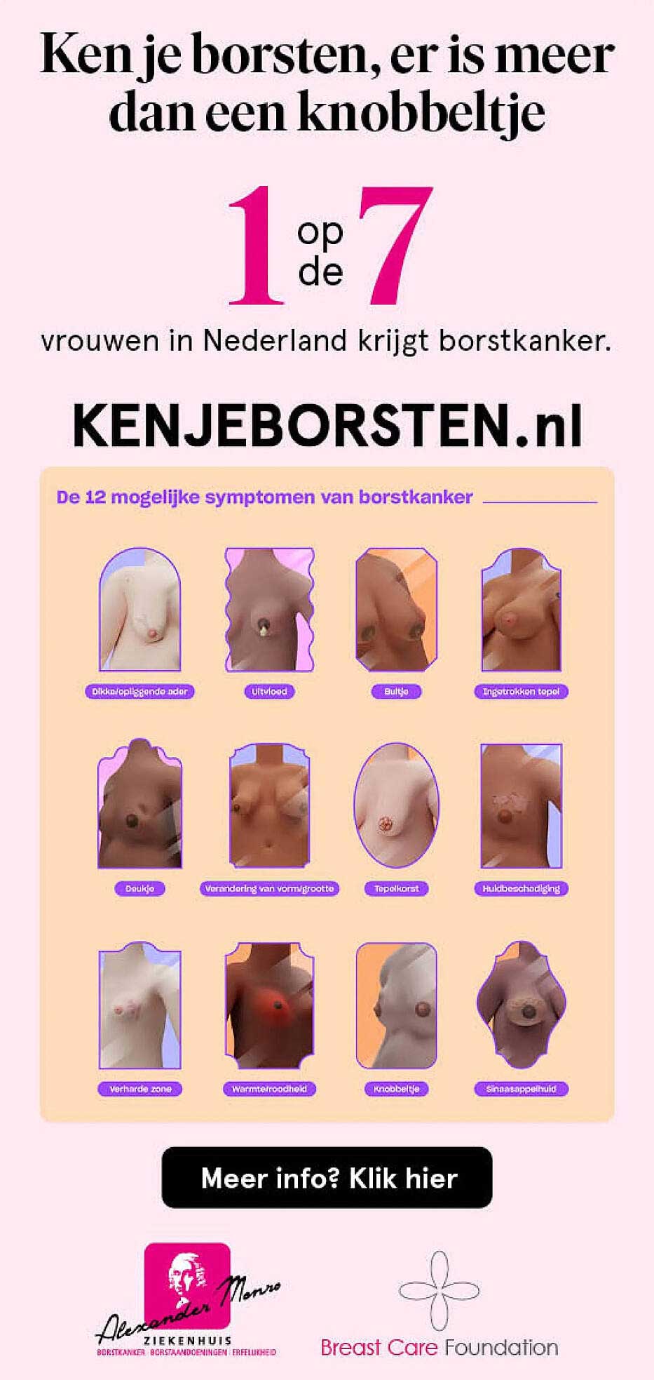 Ken je borsten, er is meer dan een knobbeltje
