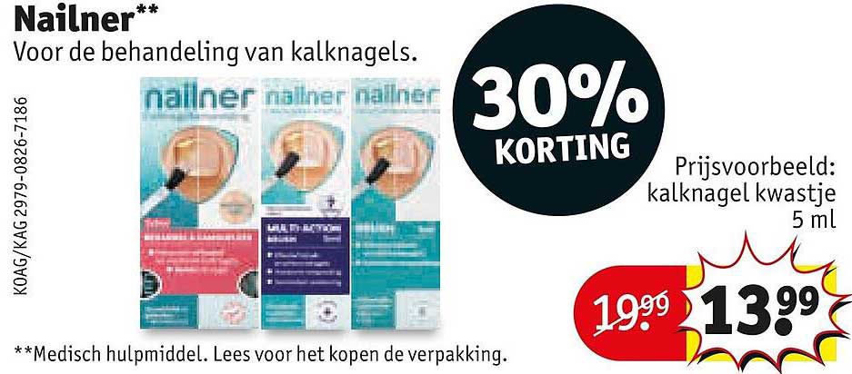 Nailner** 30% korting
